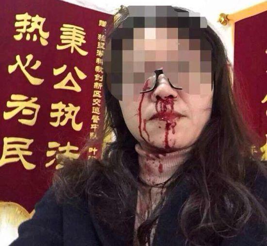 网曝苏州女老师遭交警殴打 官方:打人者被停职
