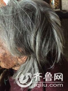 112岁老人返老还童银发变黑发