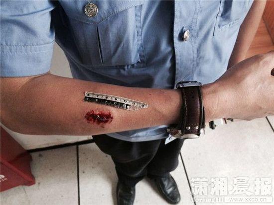 长沙两名女子咬伤执勤警察被刑拘