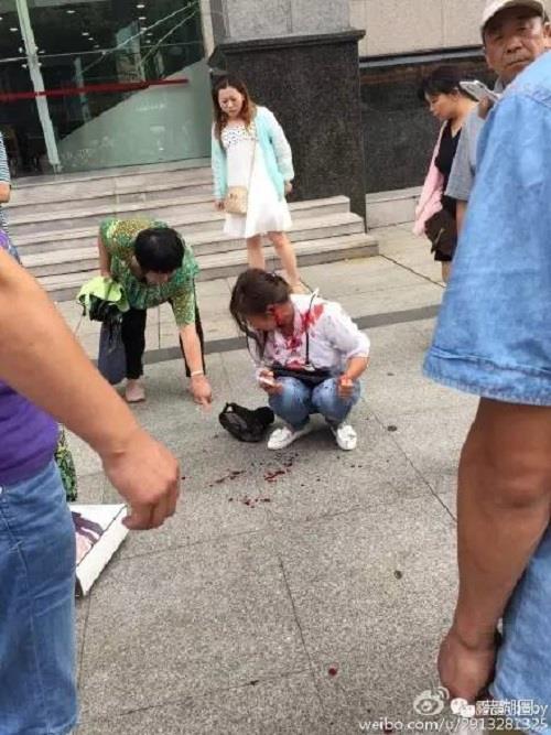 芜湖步行街一女子竟被丈夫咬下耳朵（图）