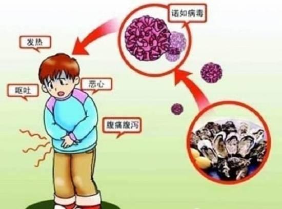 广东今年39人染诺如病毒 发病高峰人群易受影响