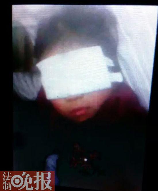 男子闯入幼儿园袭击5岁女童 致其眼角膜破裂