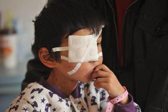 安徽男子因“嫌其吵闹” 抠7岁男童眼 警方:已刑拘
