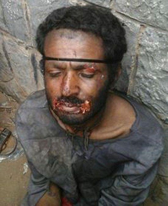 也门现现实版“吸血鬼” 被逮时在喝狗血(图)