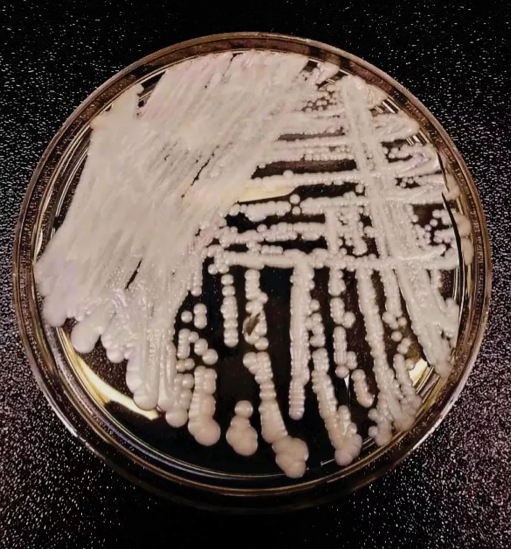养皿中的耳念珠菌菌株。图片来源/美国CDC官网