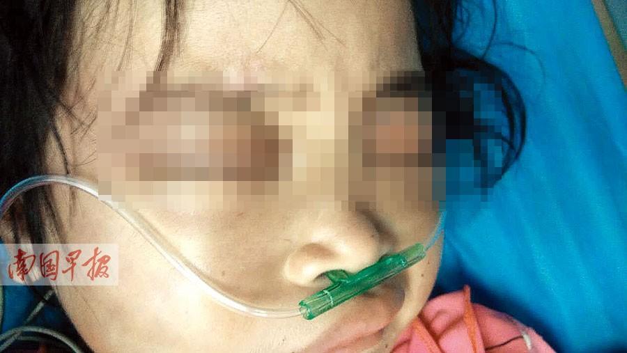 7岁女童病危全身是伤下体撕裂 家属称是摔伤(图)